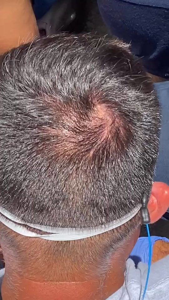 TikTok video thumbnail by shark_man33