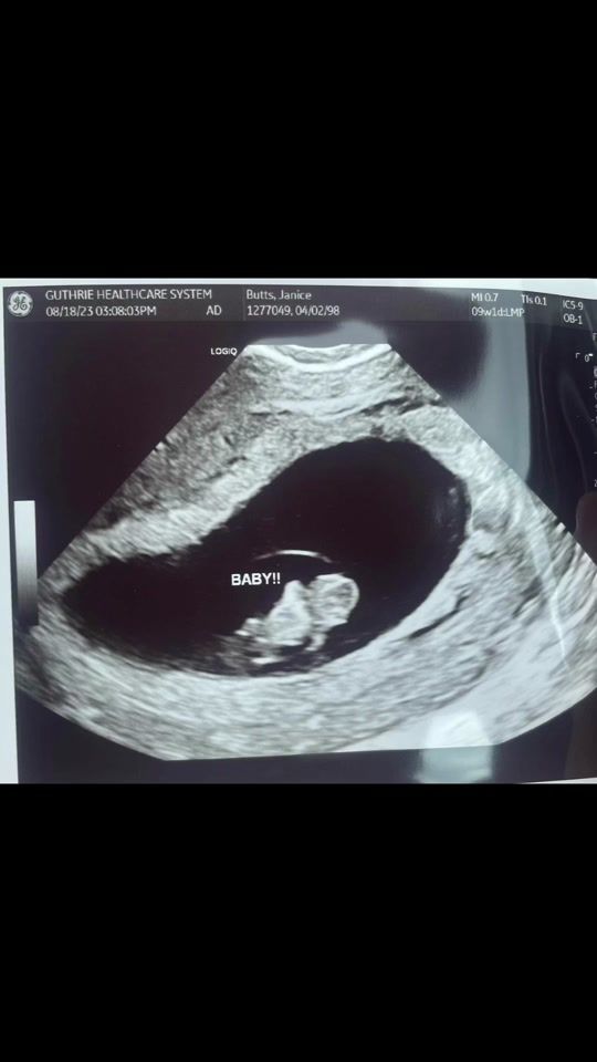 TikTok video thumbnail by dirtyyjann98