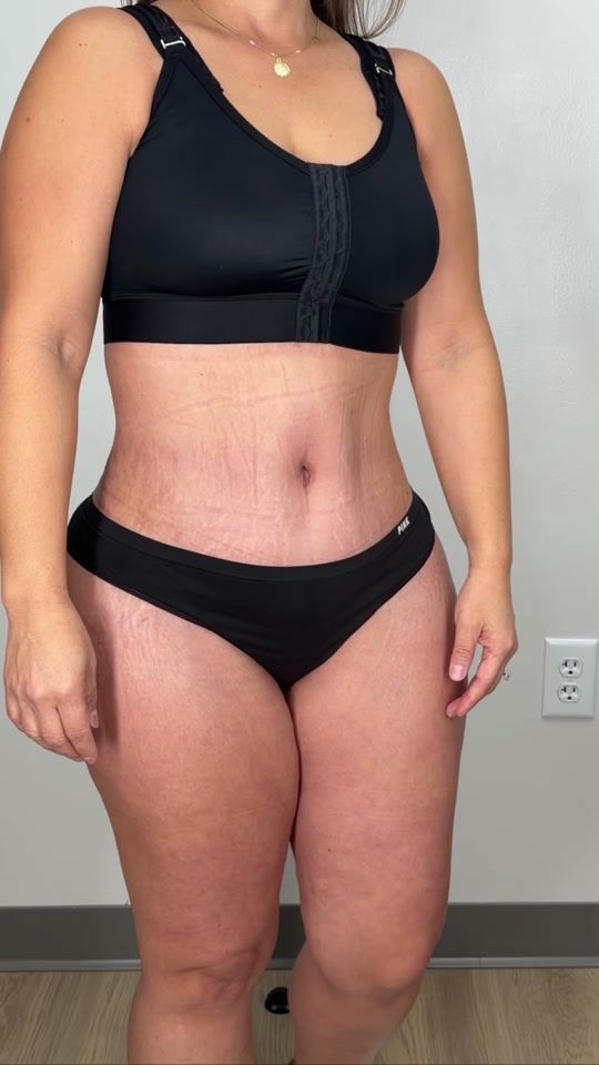 TikTok video thumbnail by vadoplasticsurgery